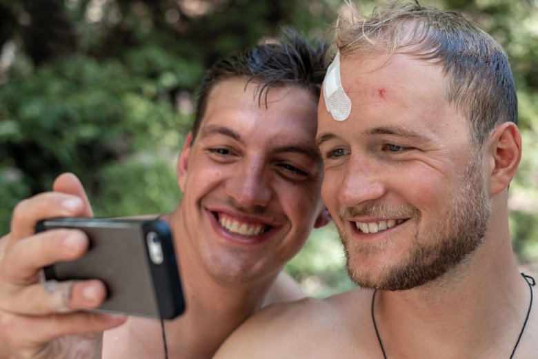 Selfie con cerotti: il nostro autore Merlino (a sinistra) con il suo amico Valentin (l&#39;infortunio &egrave; avvenuto durante il bagno, non in bicicletta).